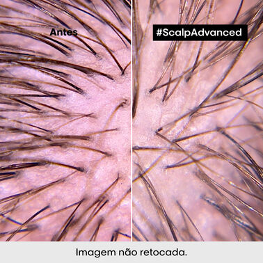 Scalp Shampoo Regulador Dermo Regulator - Bloqueado KER | L'Oréal Partner Shop