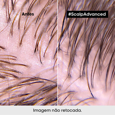 Scalp Argila Purificante 2 em 1 Deep Purifier -  | L'Oréal Partner Shop
