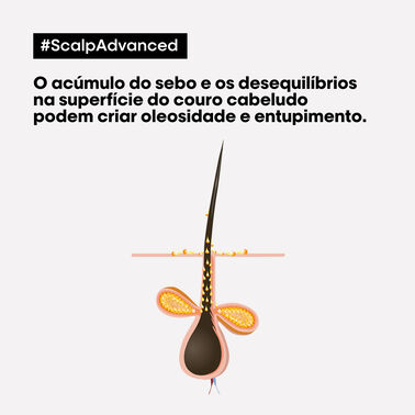 Scalp Argila Purificante 2 em 1 Deep Purifier - Bloqueado KER | L'Oréal Partner Shop